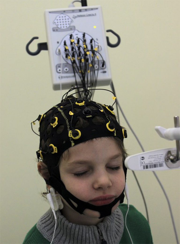 Ээг тольятти. Электроэнцефалография головного мозга (ЭЭГ). ЭЭГ РЭГ Эхо мозга головы. РЭГ И ЭЭГ. Энцефалограф Нейрон спектр 2.
